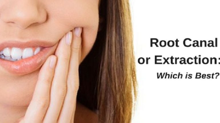 root-canal-or-extraction