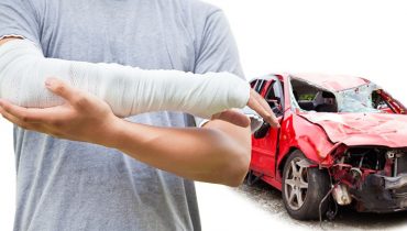 automobile injuries